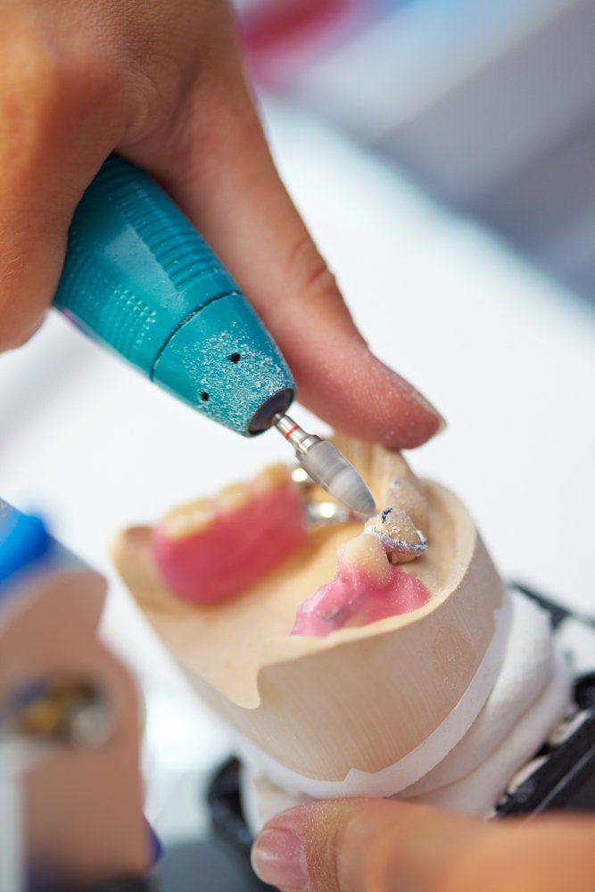 Dentista fazendo prótese dentária.