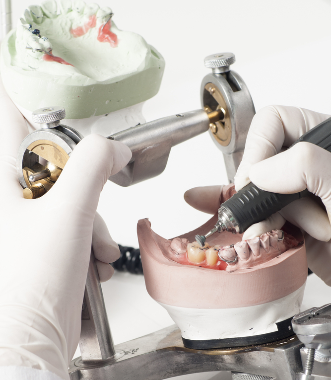 Dentista fazendo prótese dentária.