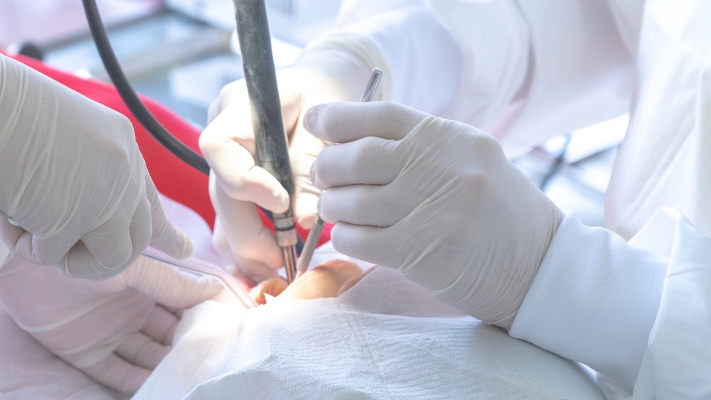 Endodontia 4 Cirurgia Oral