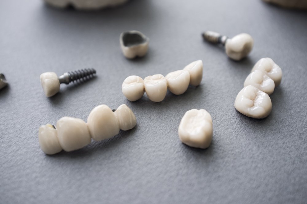 Próteses dentárias.