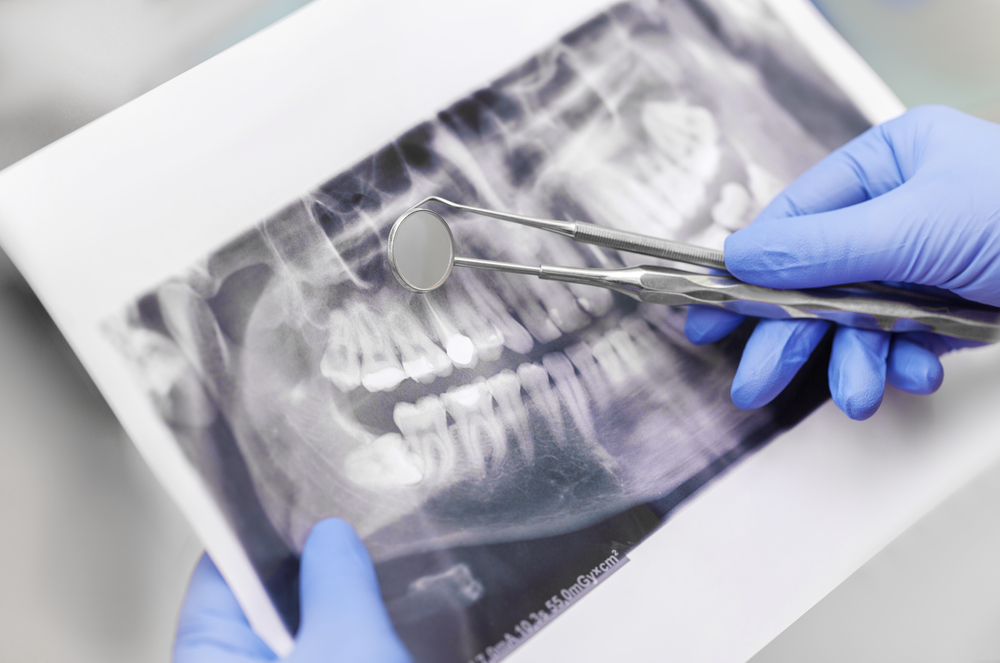 Endodontia 1 Endodontia